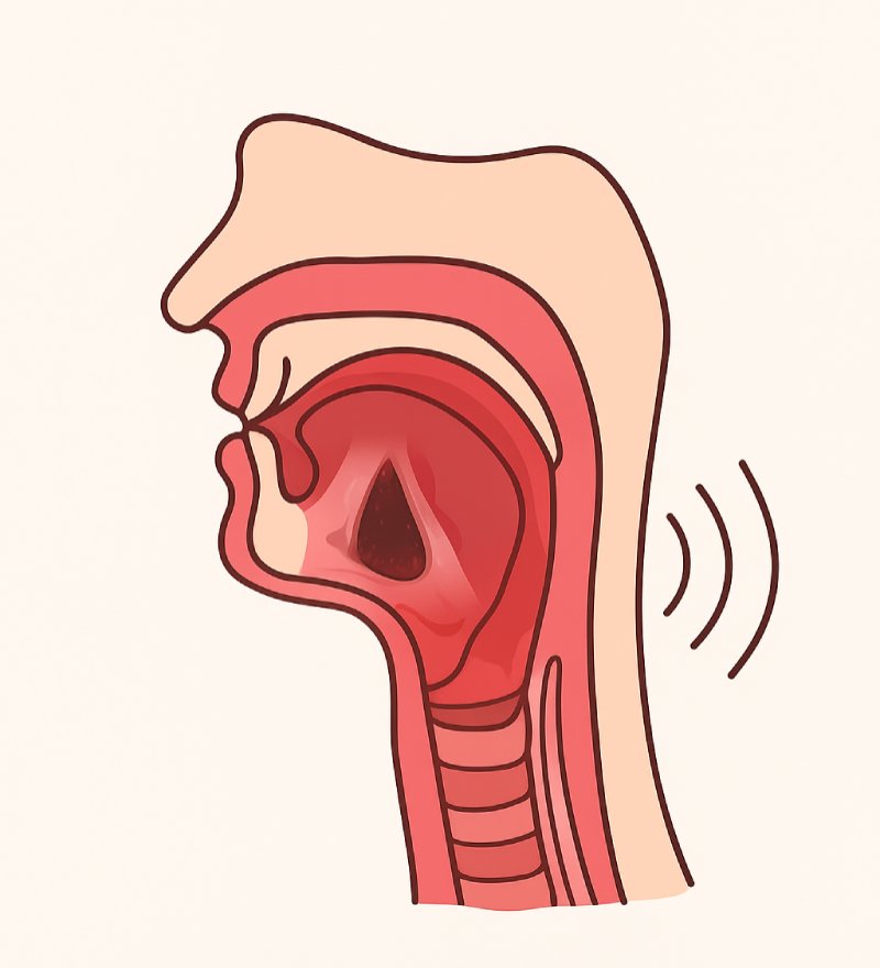 Dysphonie